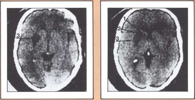 Fig.4